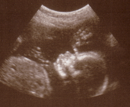AlessandraHighFive.jpg - Gimmie Five! I'll see y'all soon.